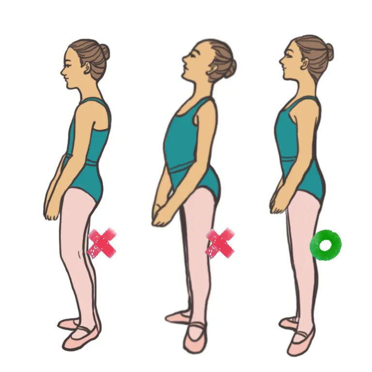 Bentuk badan tucked in (kiri) dan tucked out (tengah) menyebabkan postur badan tampak kurang baik.
Yang seharusnya dilakukan agar otot dapat bekerja secara maksimal adalah meluruskan badan seperti gambar kanan.